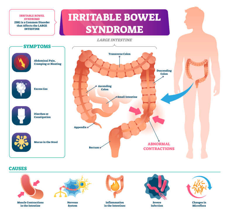 IBS priznaky